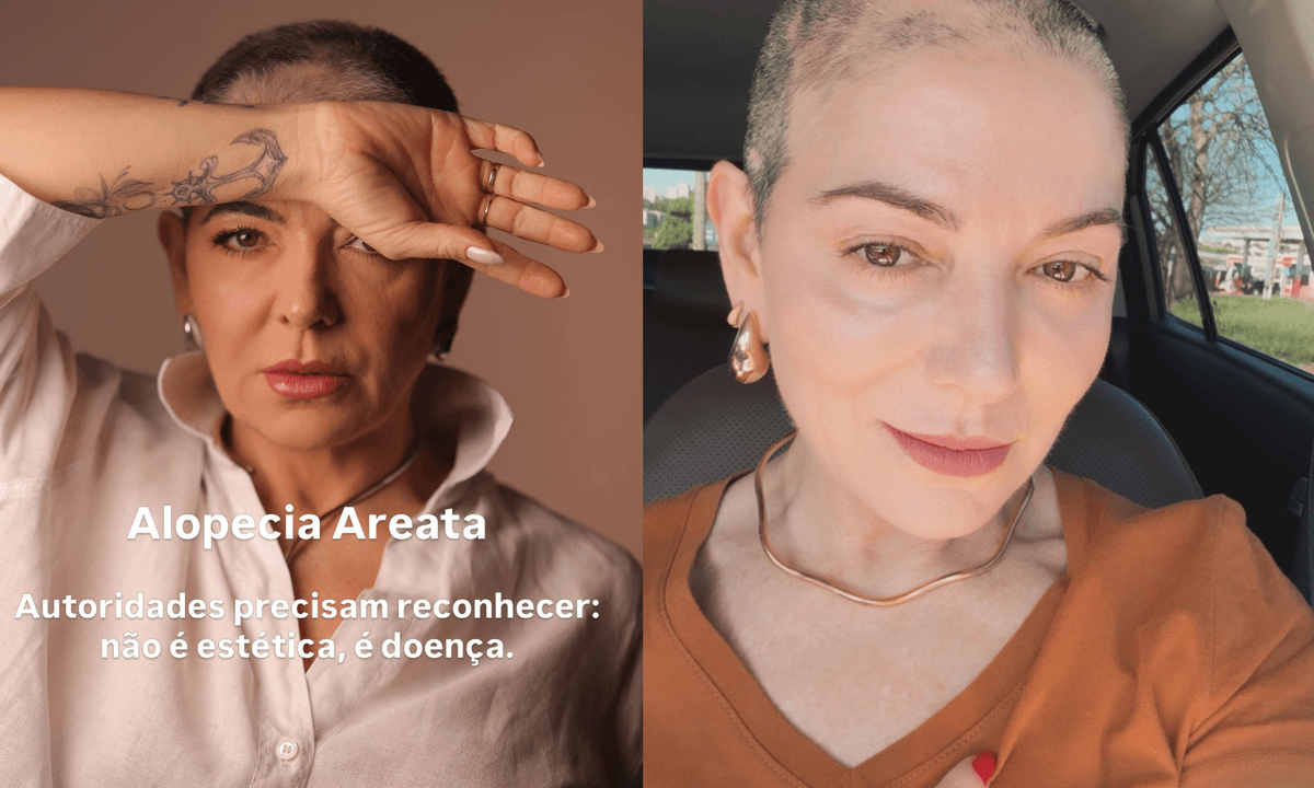 https://api.paranaibafm.com.br/mundo-dos-artistas/mae-de-lucas-lucco-fala-sobre-autoestima-apos-alopecia/attachment/foto-site-paranaiba-fm-2026-07-17t103839-570/